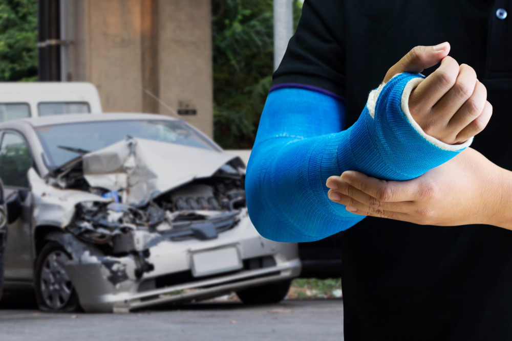 ​How Long After a Car Accident Can You Claim Injury