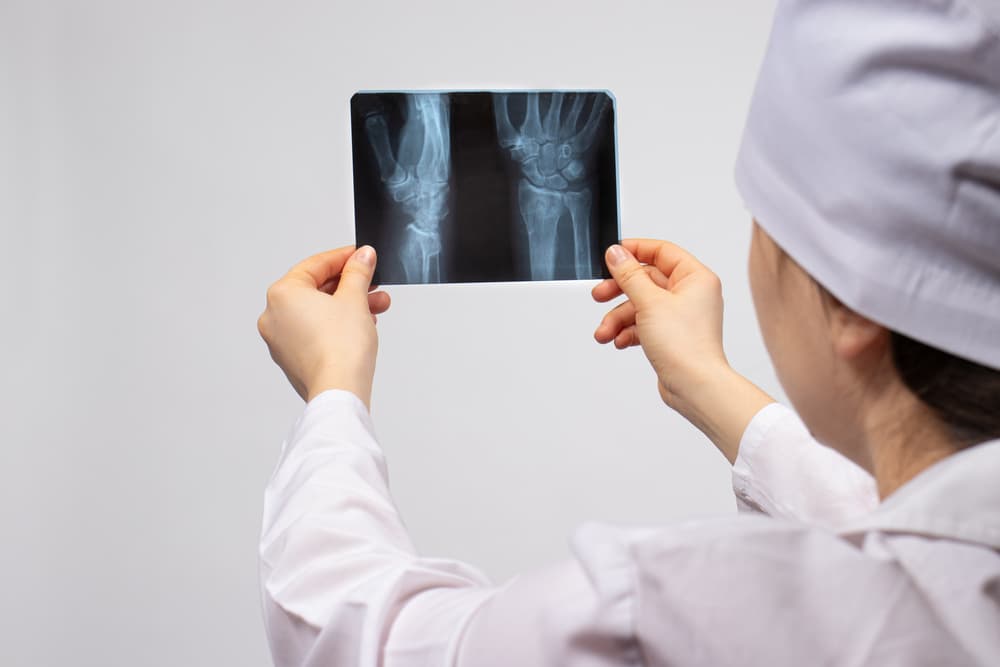 A doctor holds an X-ray of a patient with a hand injury.