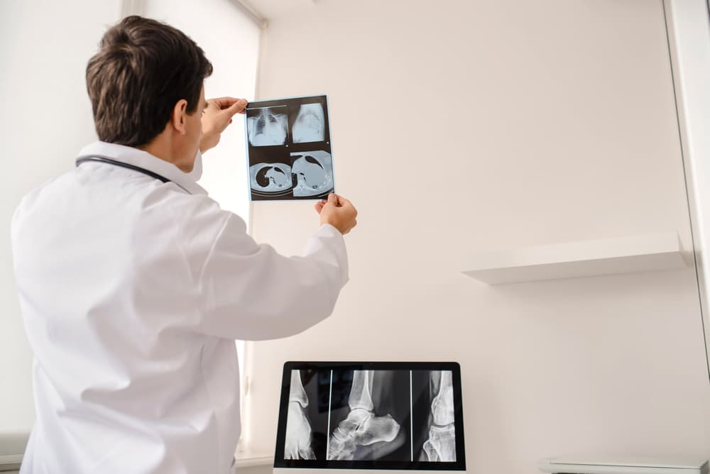 A doctor in a white coat examines X-ray images of a skull and foot, possibly related to concussion effects.